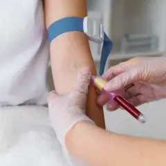 Pobieranie krwi do badań. Skierowanie na badania jest kluczowe, by wiedzieć, ile jest ważne.