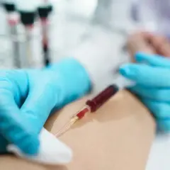 Felczer pobiera krew do strzykawki z żyły pacjenta, przygotowując próbkę do analizy.